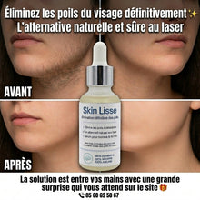 Charger l'image dans la galerie, SkinLisse : L'alternative Naturelle Au Laser Pour Les Hommes, Les Femmes, Et Les Enfants
